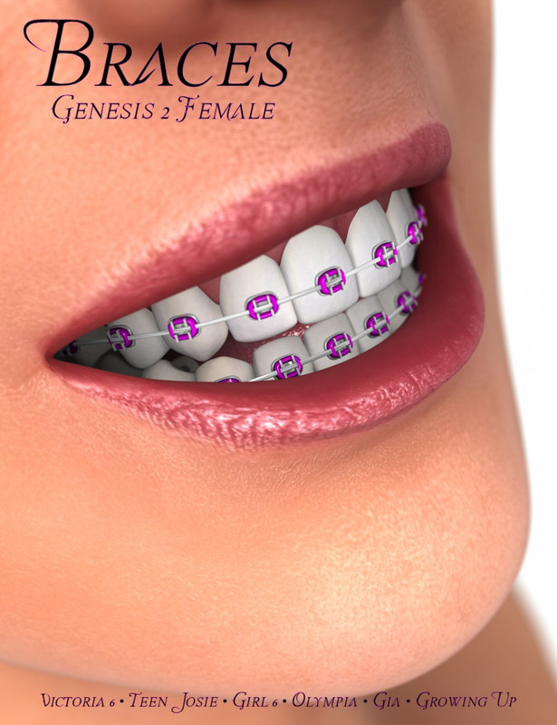 Braces for Genesis 2 Female(s)